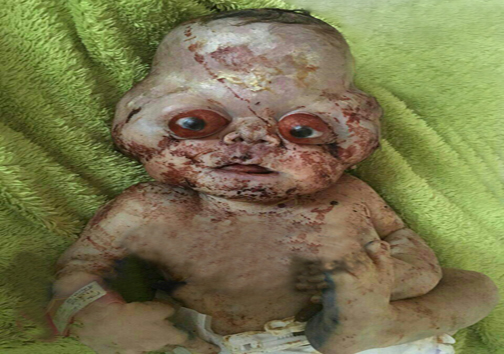 تولد نوزادی با چهره عجیب در مازندران+عکس