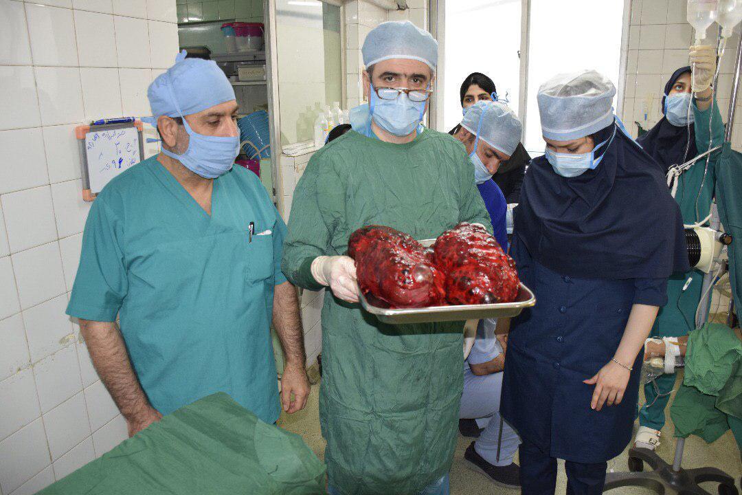 عمل موفق از کلیه‌های پلی کیستیک 12 کیلویی در بیمارستان شهید بهشتی بابل
